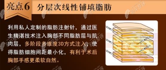 黃名斗自體脂肪豐胸技術(shù)優(yōu)勢(shì) 黃名斗自體脂肪豐胸技術(shù)優(yōu)勢(shì)