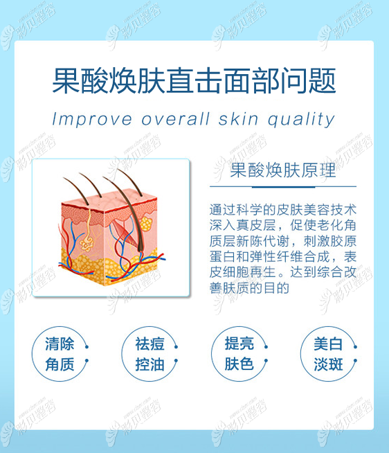 美萊果酸煥膚的原理 美萊果酸煥膚的原理