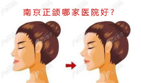 南京做正頜手術(shù)哪家醫(yī)院好,想找數(shù)字化正頜技術(shù)好的醫(yī)院哦