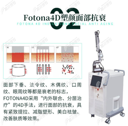 歐洲之星電波拉皮的作用原理 歐洲之星電波拉皮的作用原理