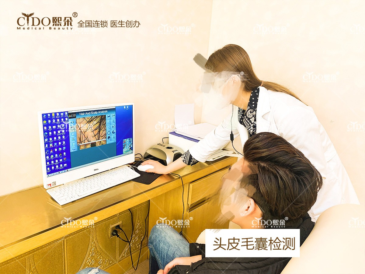 青島熙朵植發(fā)門診部頭皮毛囊檢測(cè)