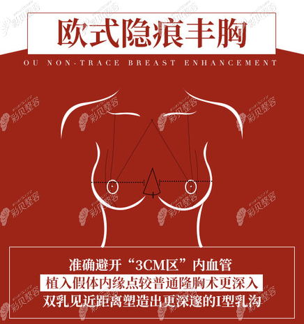 烏魯木齊伊麗莎白整形豐胸技術(shù)怎么樣