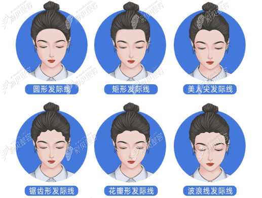 南昌碧蓮盛植發(fā)