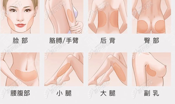 適合抽脂的部位