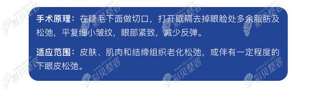 外切去眼袋的手術(shù)原理 外切去眼袋的手術(shù)原理