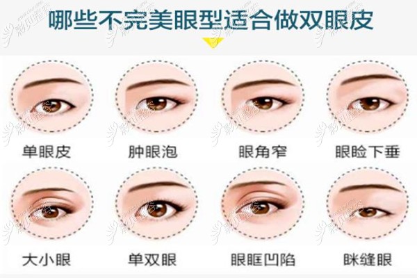 深圳藝星呂瑛醫(yī)生雙眼皮手術(shù)做的自然，恢復(fù)速度還挺快