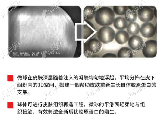 少女針有膠原蛋白增生的功效 少女針有膠原蛋白增生的功效