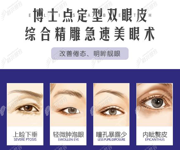 烏魯木齊伊麗莎白肖鴻俊醫(yī)生割雙眼皮怎么樣
