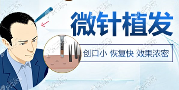 微針植發(fā)怎么樣 微針植發(fā)怎么樣