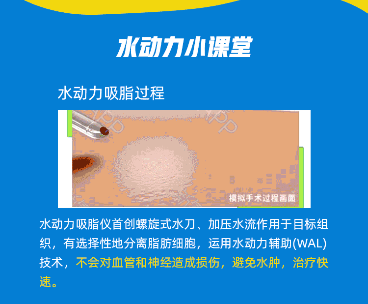 鄭州做面部吸脂術(shù)比較好的醫(yī)生給女子做完之后臉不會(huì)變僵