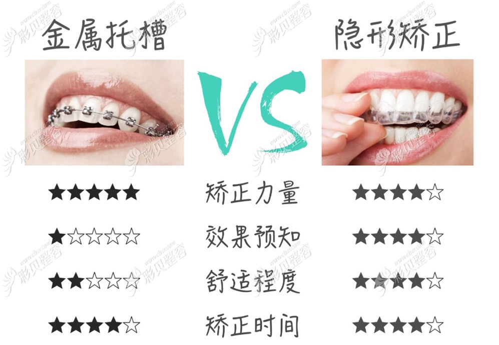 金屬托槽矯正和隱形矯正哪個好 金屬托槽矯正和隱形矯正哪個好