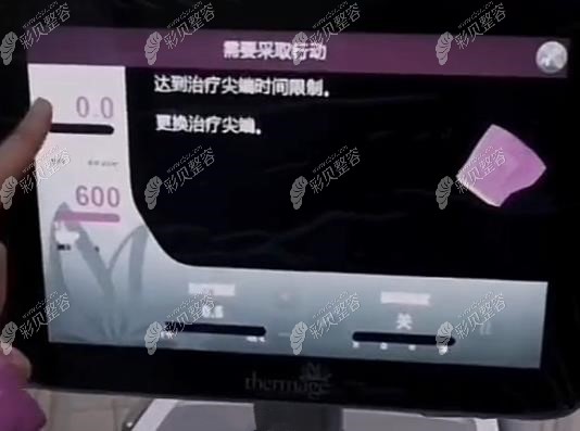 第五代熱瑪吉使用時(shí)間超過2個(gè)小時(shí)會(huì)怎么樣 第五代熱瑪吉使用時(shí)間超過2個(gè)小時(shí)會(huì)怎么樣