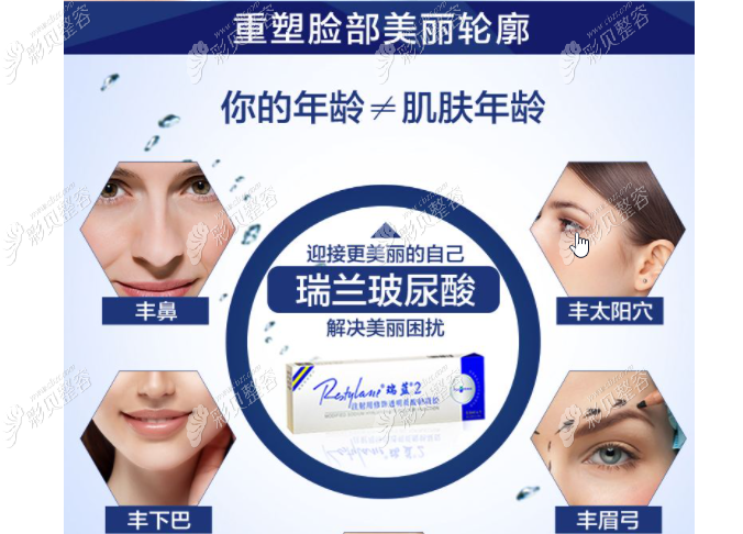 瑞藍玻尿酸隆鼻