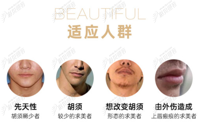 男生想留絡腮胡但不長怎么辦——種植胡須呀