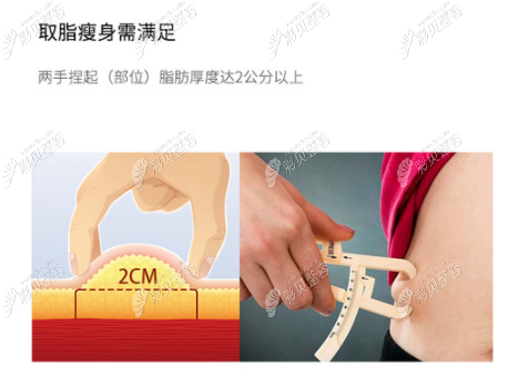 手臂吸脂是全麻還是局麻，局麻的話到底疼不疼