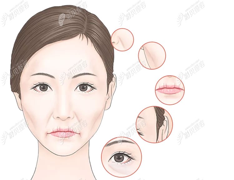 V美減齡V9改善全臉的皺紋問題 V美減齡V9改善全臉的皺紋問題