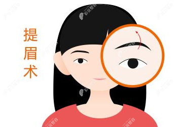 錦州斯美諾做提眉手術(shù)大約多少錢？花8000塊錢能不做懸眉不