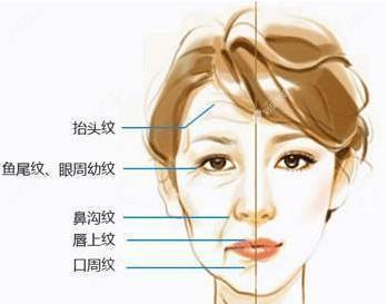 筋膜折疊術(shù)和筋膜懸吊哪個好?區(qū)別不止維持時間的不一樣喲