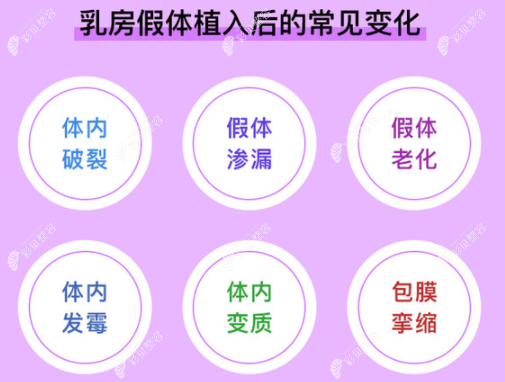 硅膠隆胸假體取出需要多少錢,取出后還可以在做哪些豐胸