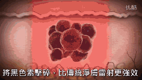 從療效看,祛斑是用超皮秒激光還是美國賽諾秀c10哪個表現(xiàn)好