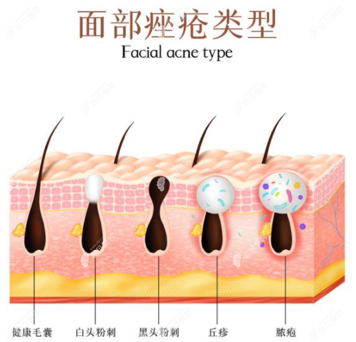 浙江嘉興曙光周麗玲醫(yī)生怎么樣 浙江嘉興曙光周麗玲醫(yī)生怎么樣