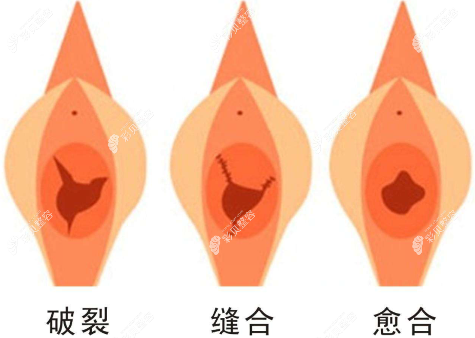 烏魯木齊哪家醫(yī)院做處女膜修復(fù)好，修復(fù)后還會(huì)出血嗎