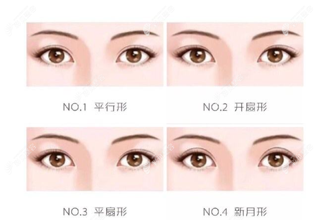 范萌知醫(yī)生做雙眼皮怎么樣