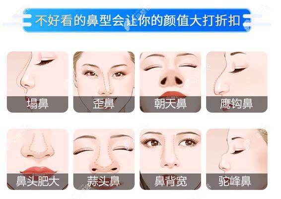 張龍?jiān)洪L(zhǎng)可以改善的鼻型