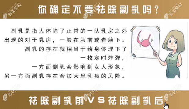 切除副乳的好處 切除副乳的好處