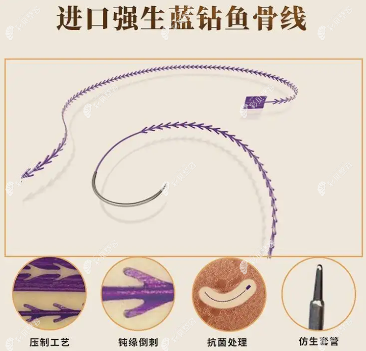 美國強(qiáng)生魚骨線怎么樣 美國強(qiáng)生魚骨線怎么樣