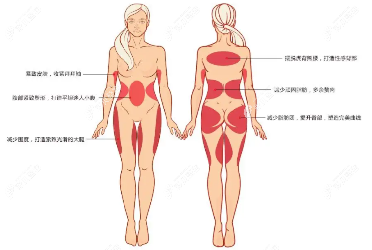Fotona歐洲之星火鳳凰溶脂怎么樣全面分析,內(nèi)含優(yōu)勢、價格等