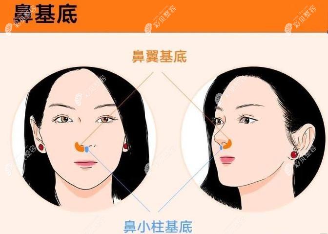 鼻基底和法令紋的區(qū)別不只是位置不同，改善方法也不一樣
