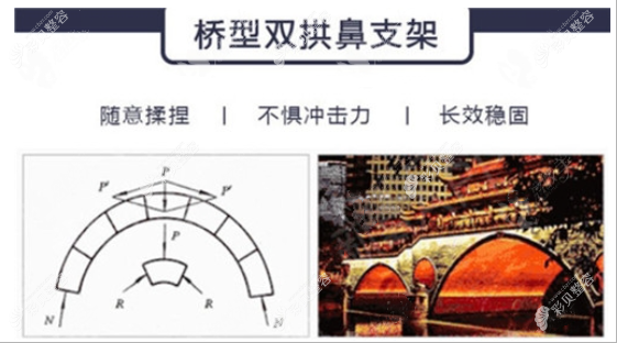 雙拱橋鼻支架的原理和特點(diǎn)