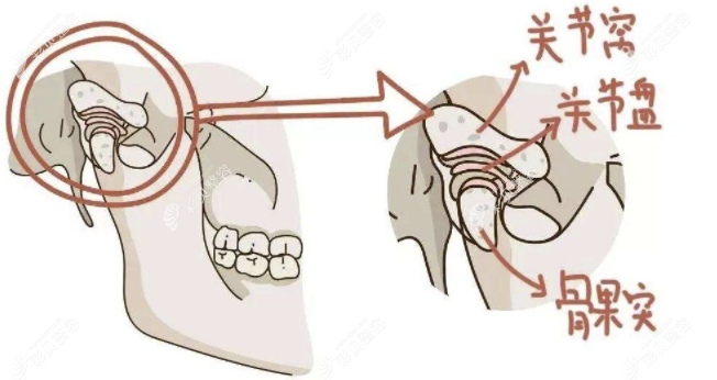 顳頜關(guān)節(jié)的構(gòu)成