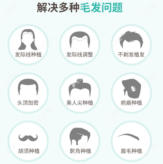 剛植完頭發(fā)要注意哪些及后期需要怎么養(yǎng)護的內(nèi)容分享