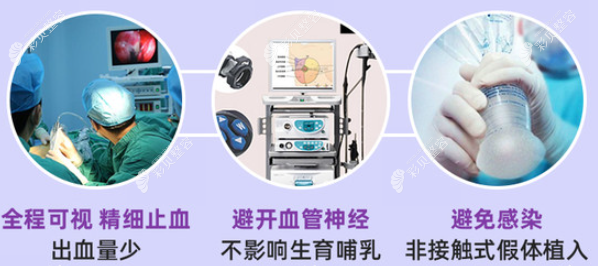 喬長(zhǎng)順院長(zhǎng)使用內(nèi)窺鏡隆胸手術(shù)