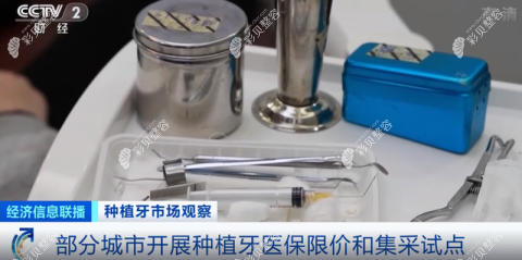 部分城市已開展種植牙醫(yī) 保限價和集采試點 部分城市已開展種植牙醫(yī) 保限價和集采試點
