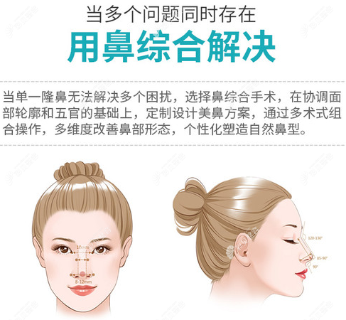 鼻綜合手術(shù)的必要性cbzr.com