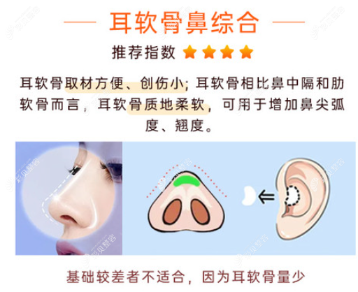 洛陽(yáng)華美做鼻子好的醫(yī)生是張書(shū)明院長(zhǎng)和唐向東醫(yī)生