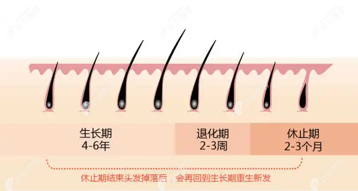植發(fā)只能維持兩到三年不可信,我植發(fā)五年后頭發(fā)并沒有復(fù)脫