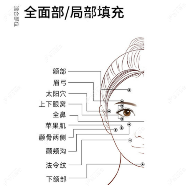 張紅芳面部填充怎么樣?其實(shí)張紅芳面部填充價(jià)格和技術(shù)成比