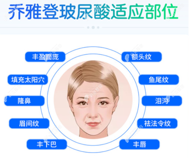 玻尿酸隆鼻維持時(shí)間一般是多久 玻尿酸隆鼻維持時(shí)間一般是多久