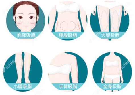 銀川全身吸脂哪個醫(yī)生好,銀川抽脂好的是黃堂慶/馬永東...
