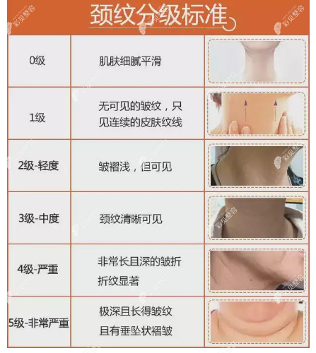頸紋的去除方法有哪些?aeces.cn 頸紋的去除方法有哪些?aeces.cn