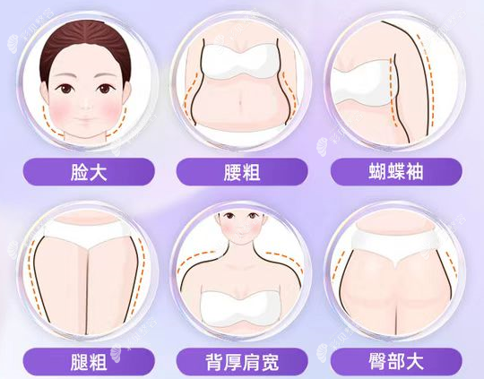大腿抽脂做完能馬上走路回家嗎,第二天可以正常上班嗎