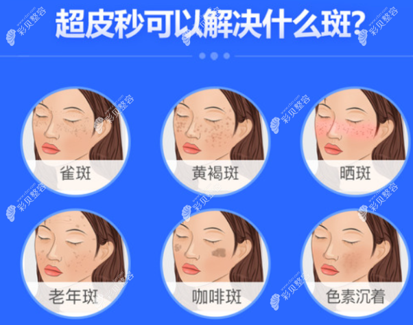 蔡碧玉醫(yī)生祛斑技術(shù)怎么樣