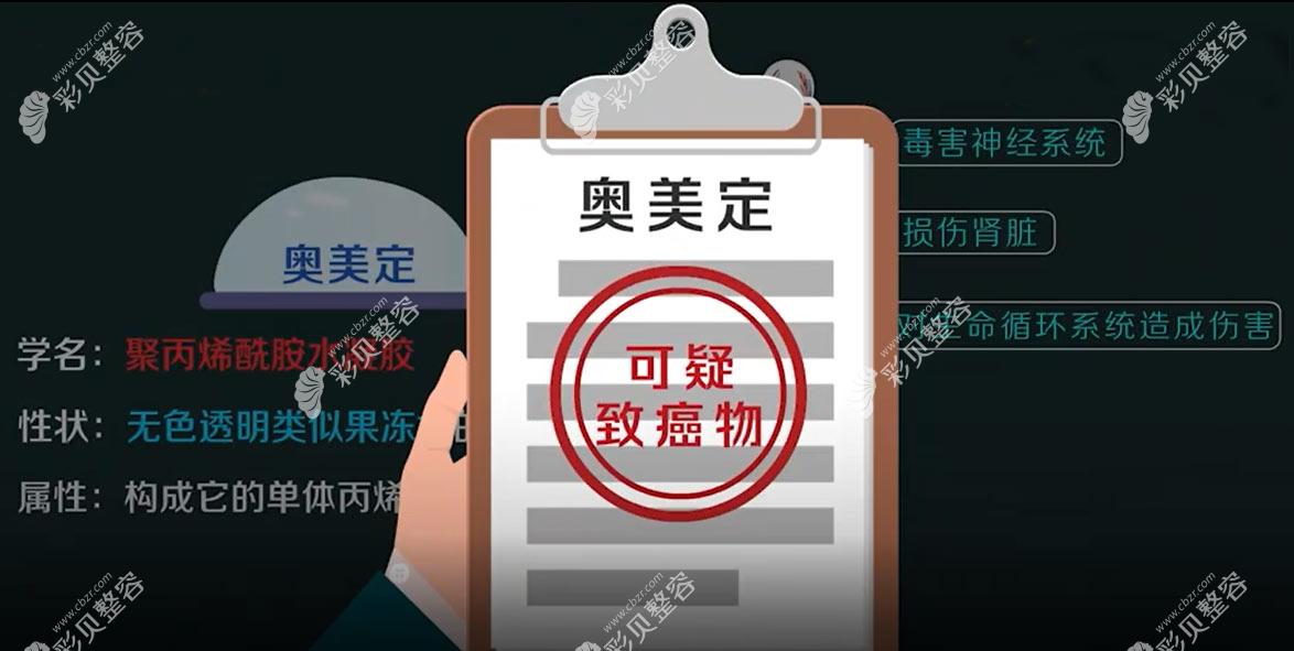 取出奧美定胸的人現(xiàn)在咋樣?從胸部清奧3個(gè)月經(jīng)歷看沒后遺癥