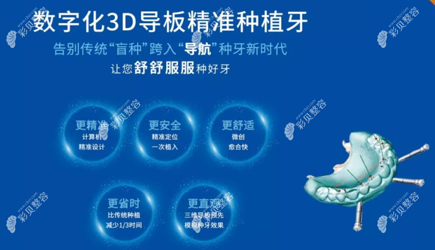 數(shù)字化導(dǎo)板種植牙的利和弊 數(shù)字化導(dǎo)板種植牙的利和弊