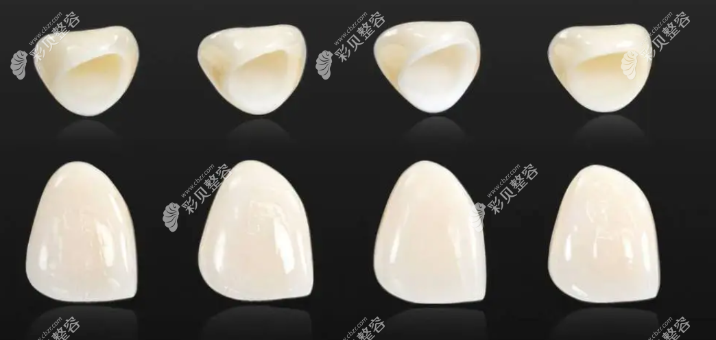 ?？谖ㄐX科牙冠品牌
