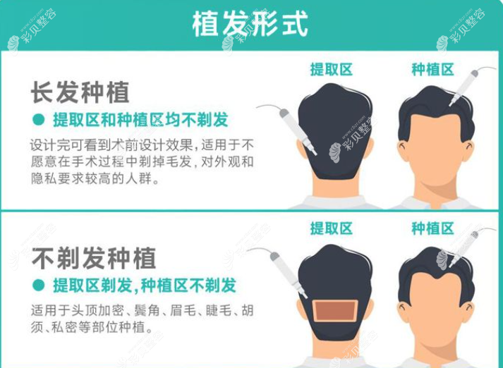 遵義毳森植發(fā)怎么樣